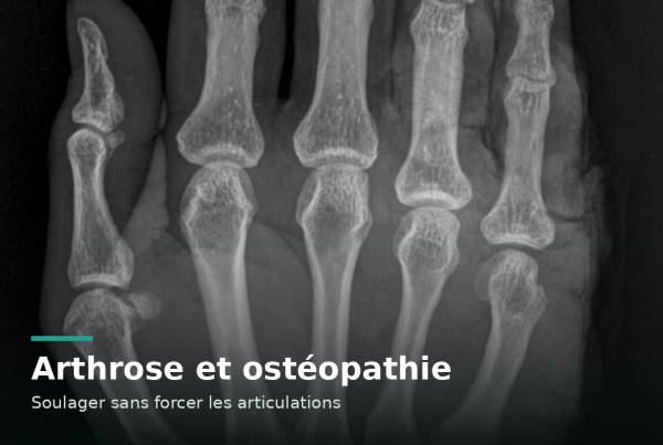 Radiographie d'une main montrant les articulations des doigts et la base du pouce